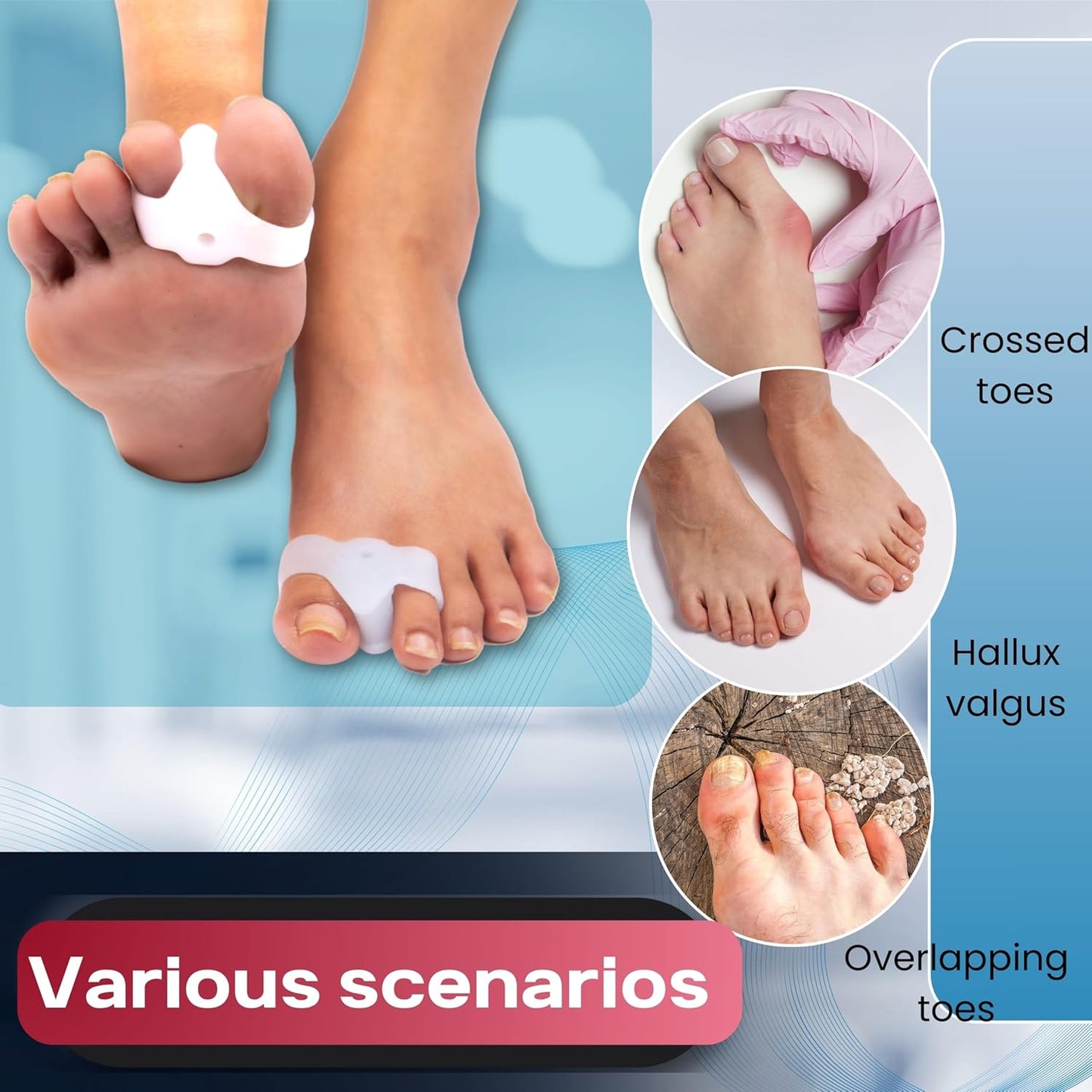 Wonder Care Silicone Toe Separator For Feet Gel Toe Pads Toe Big Toe Corrector Bunion Toe Straightener Yoga Toe Stretcher Hammer Toe Bunion [Pair of 1-2 Pieces]