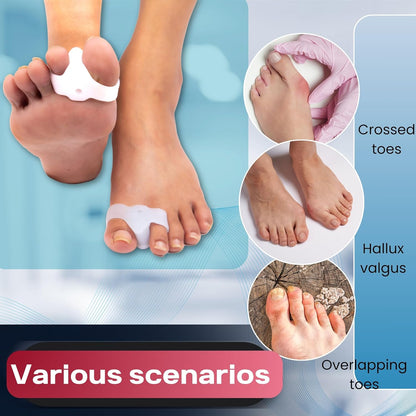 Wonder Care Silicone Toe Separator For Feet Gel Toe Pads Toe Big Toe Corrector Bunion Toe Straightener Yoga Toe Stretcher Hammer Toe Bunion [Pair of 1-2 Pieces]